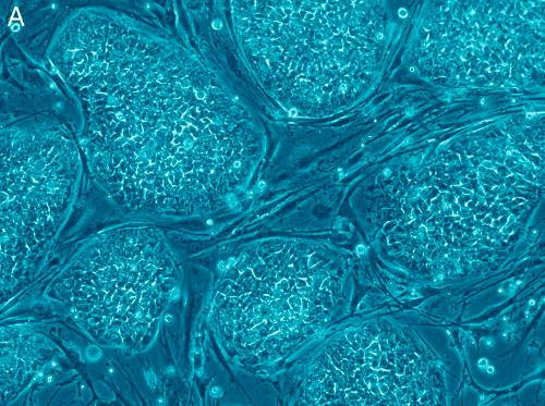 Human embryonic stem cells.